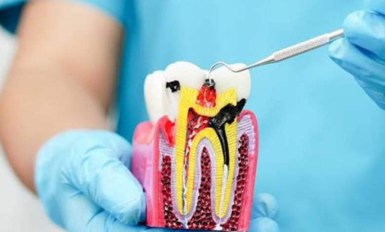 root canal near me
