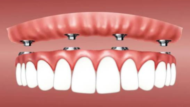 snap in dentures near me