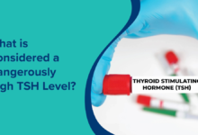 what is considered a dangerously high tsh level